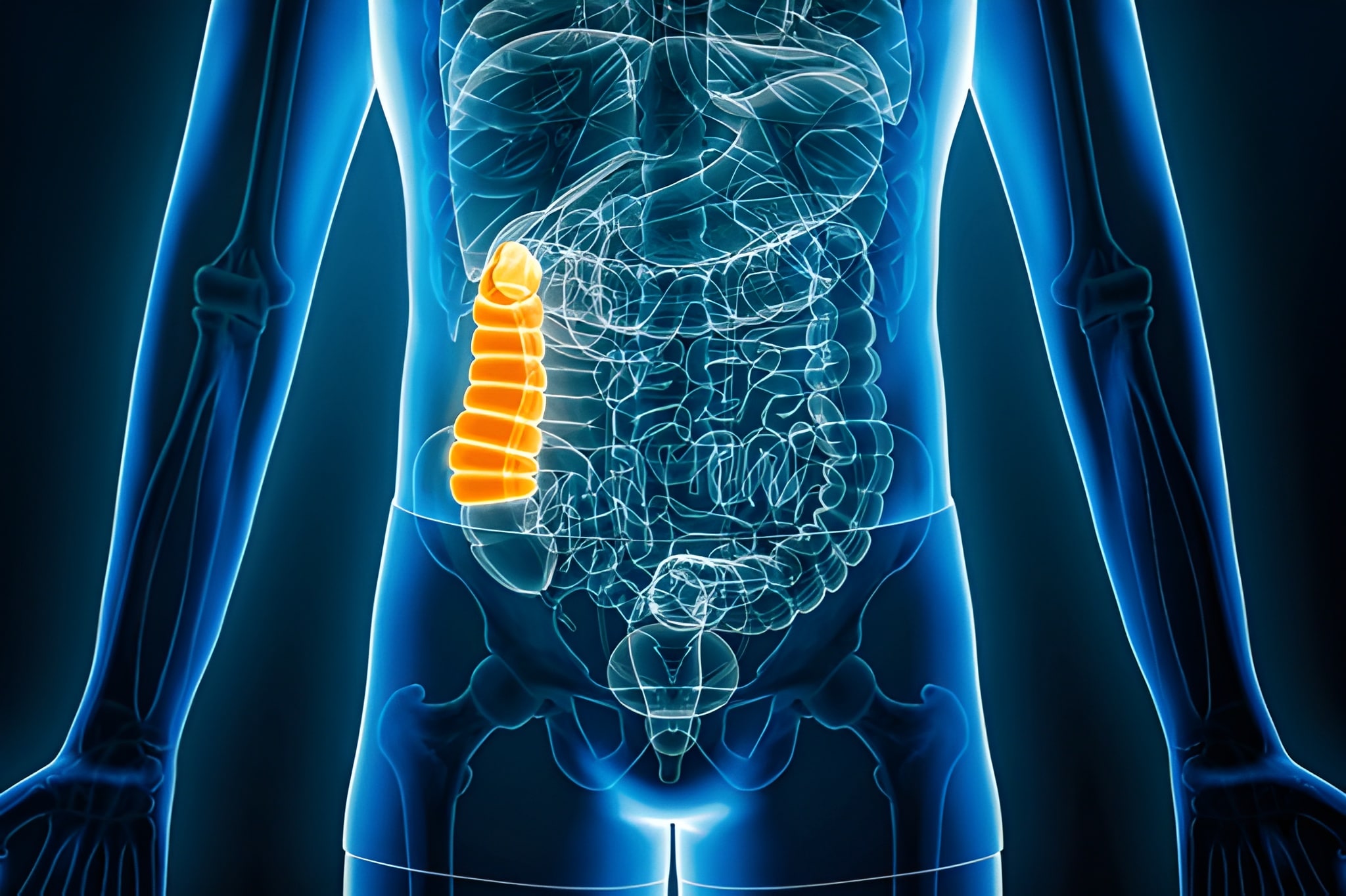 Colon Transit Study — Sitz Marker Test for Constipation