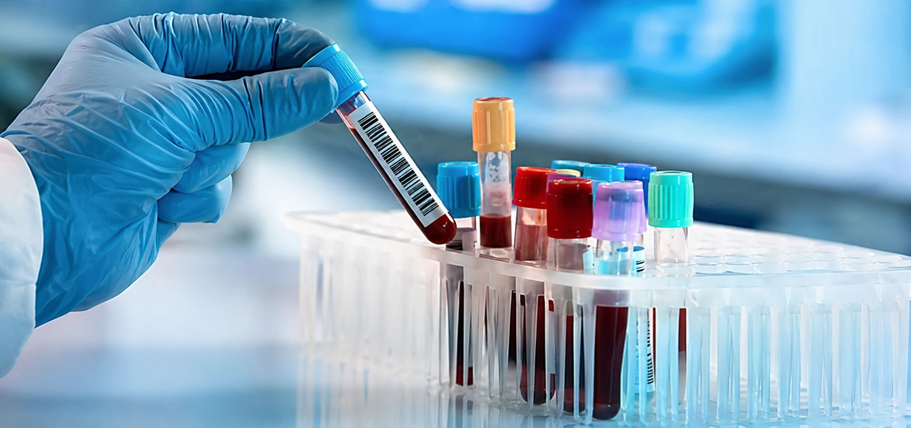 Cost of Medical Tests in Shyamoli (X-ray, Blood Test)